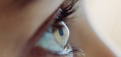 queratocono o deformación en cornea